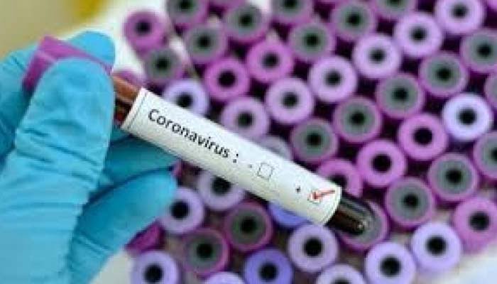 Coronavirus-sir